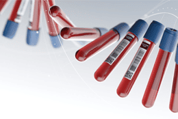 Cancer Blood Tests